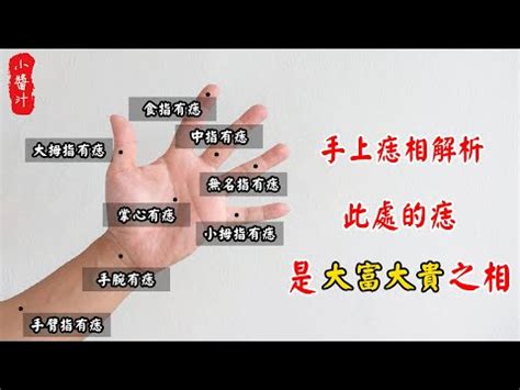 左手掌左手手上的痣|手掌痣位圖：如何解讀你的命運？